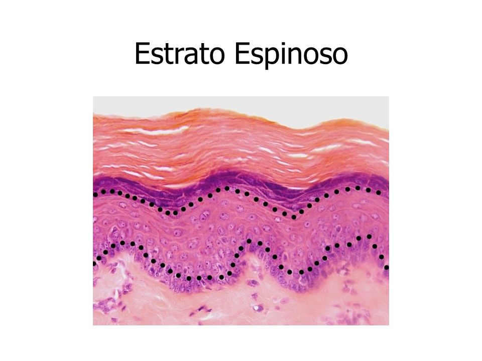 ESTRATO ESPINOSO DOWNLOAD ESTRATO ESPINOSO DOWNLOAD